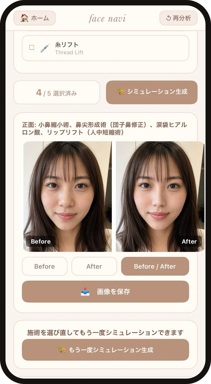 施術シミュレーションのBefore/After画面